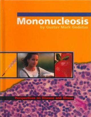 Mononucleosis - Thryft